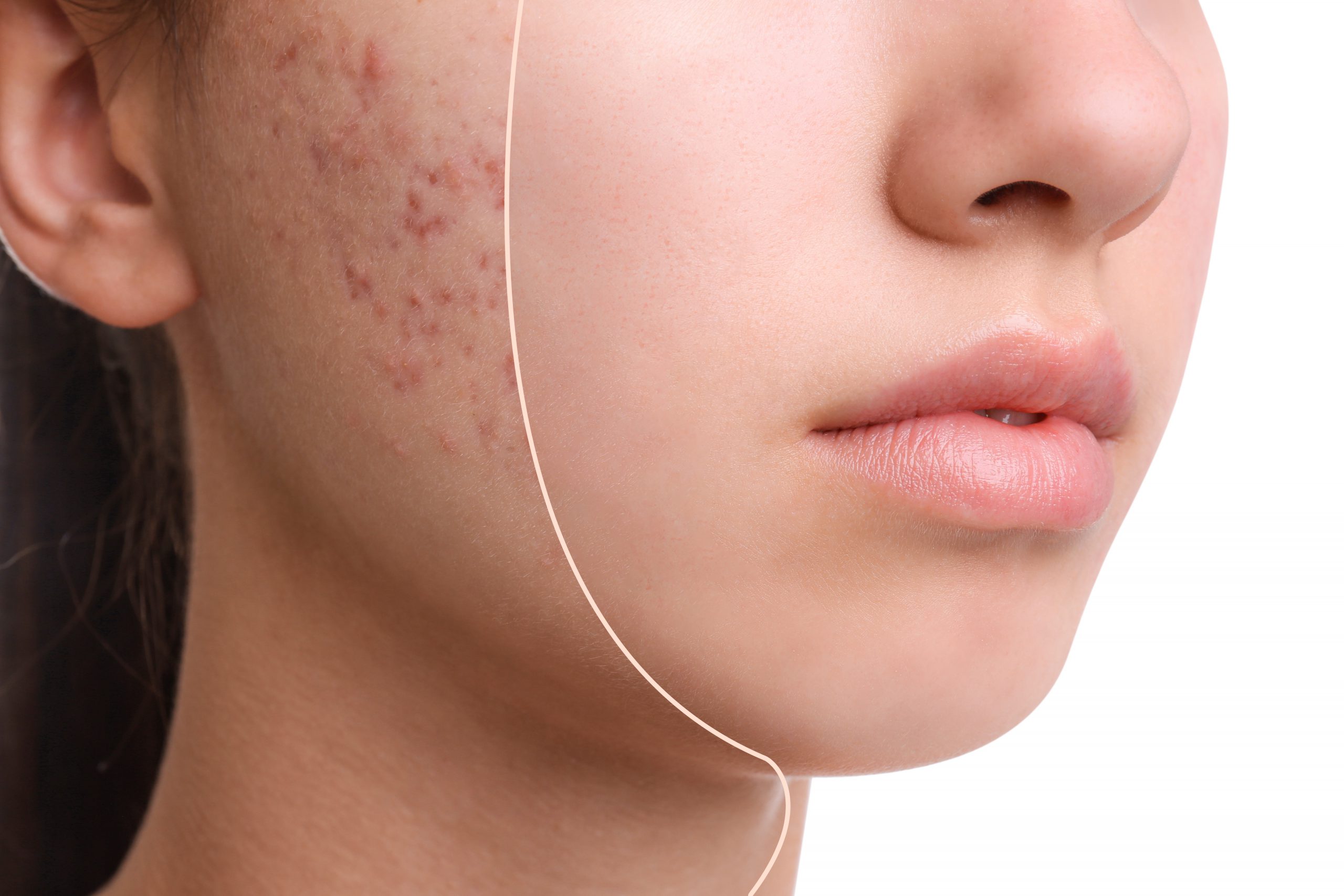Custom facial treatment at Sedora Spa Syracuse
