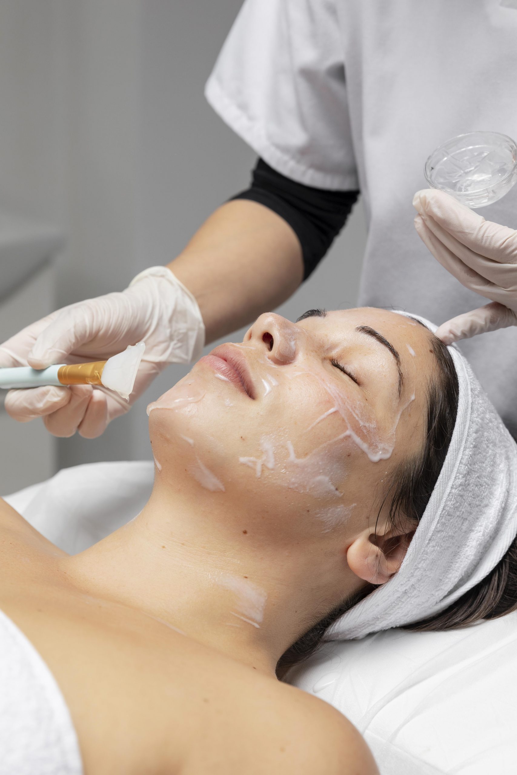 Chemical peel treatment